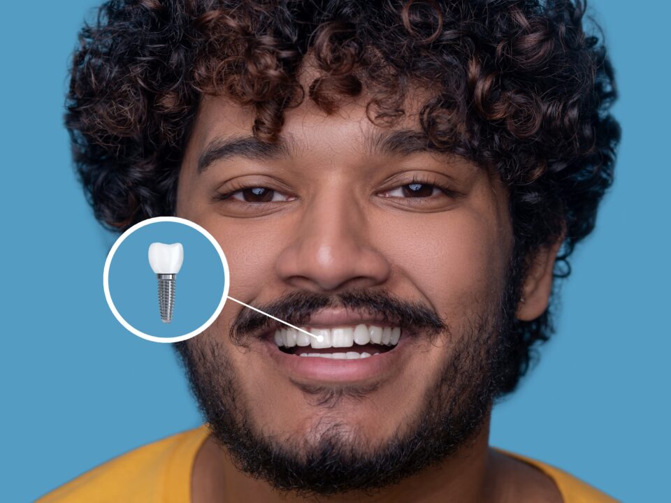 dental implants in Garland