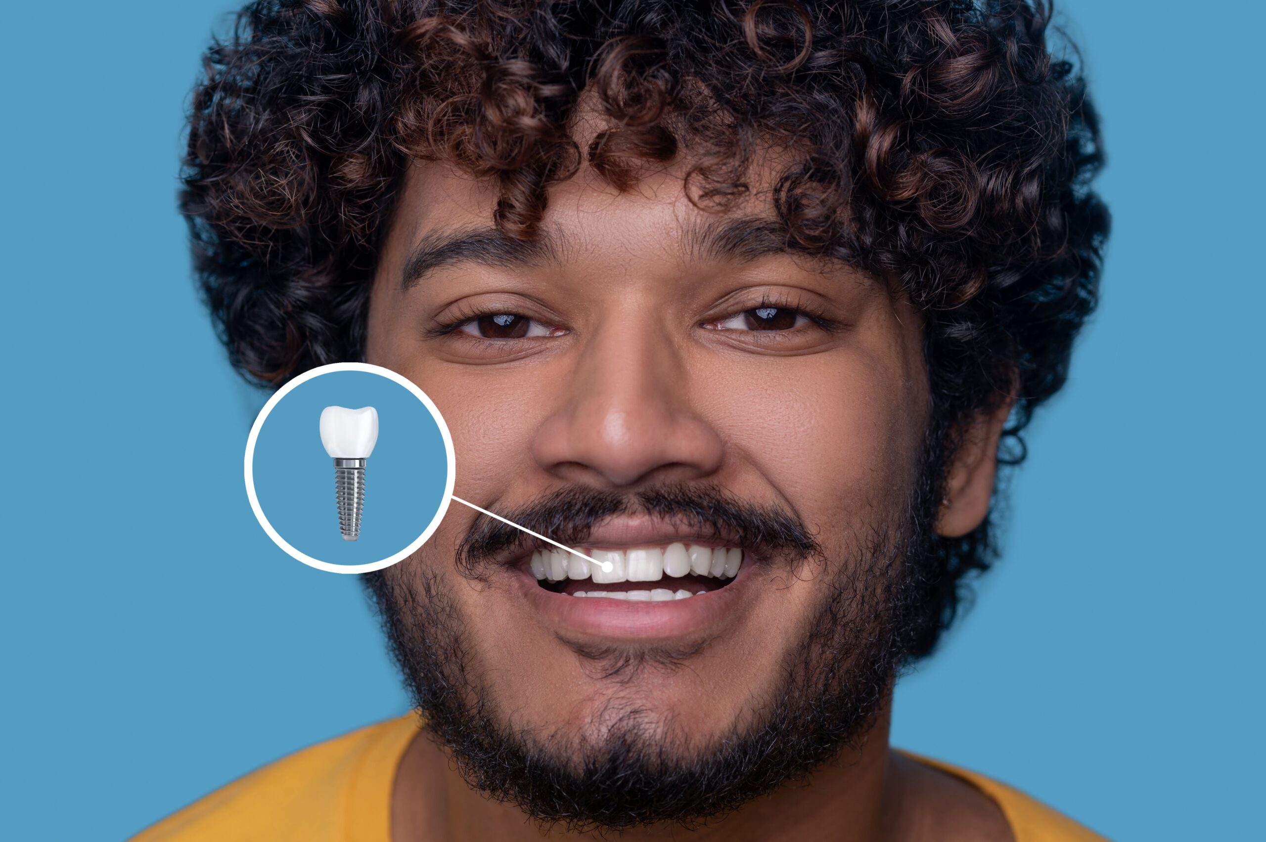 dental implants in Garland